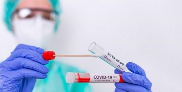 Rapid Diagnostic Test Antigen Resmi Digunakan Untuk Penyelidikan Epidemiologi
